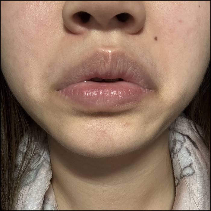 The sound of fatigue.